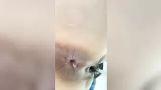 Hospital_Toilet_2