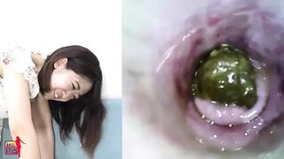 BFH-176 04 Her most embarrassing hole. VOL. 6