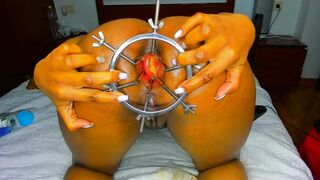 FEXIBLEBODY - Speculun anal